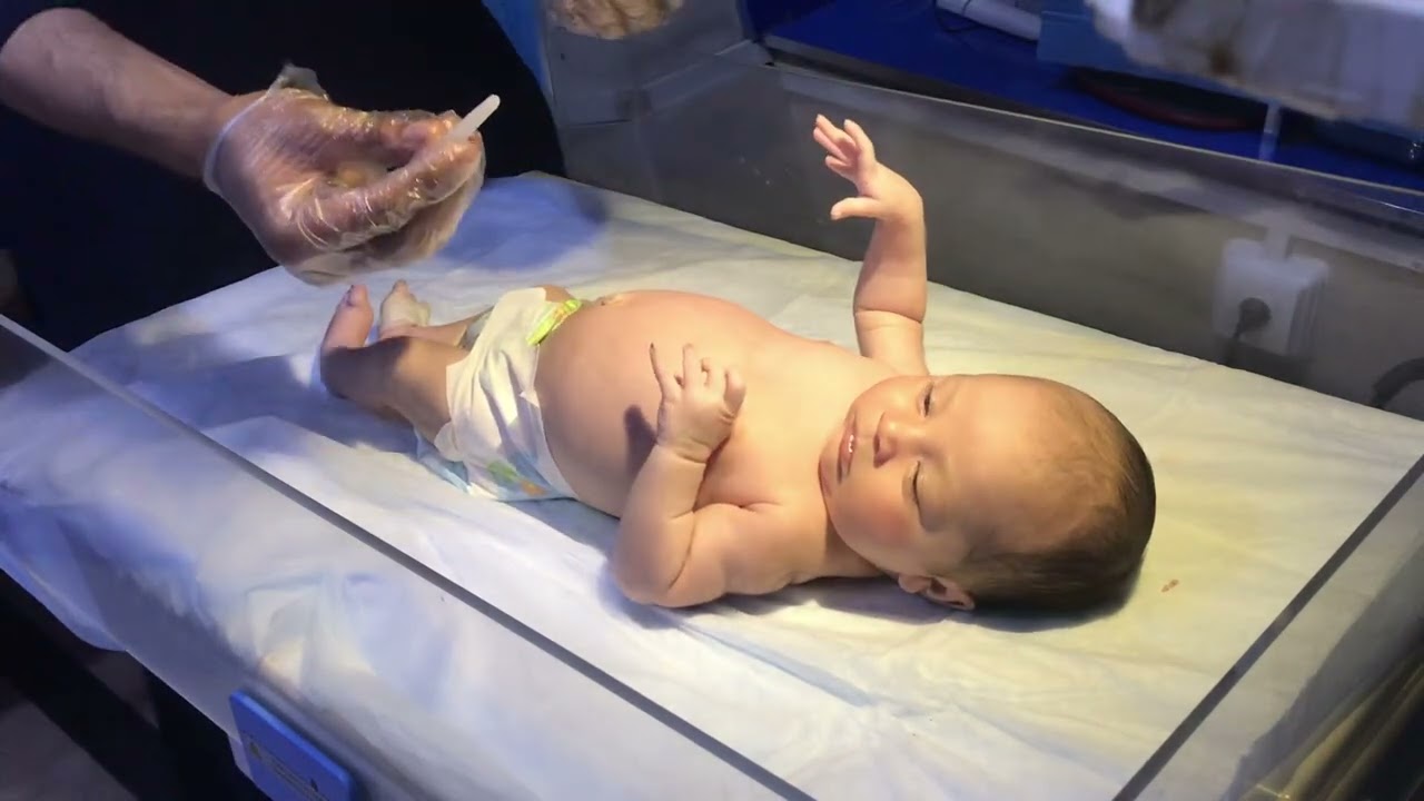 Newborn Baby with Constipation | Glycerin Suppository for Stool Passage