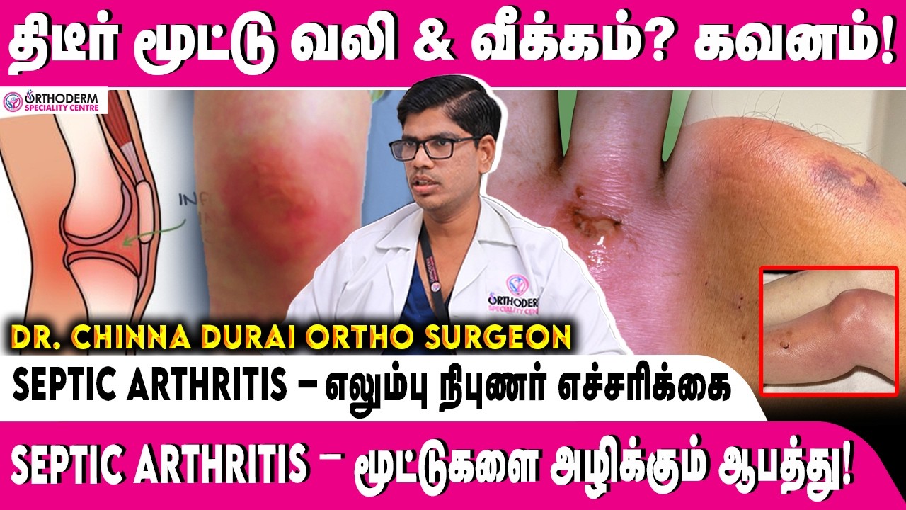 மூட்டு வலியை அலட்சியம் செய்தால் என்ன ஆகும்? Septic Arthritis உண்மை! #kneepain #bonehealth