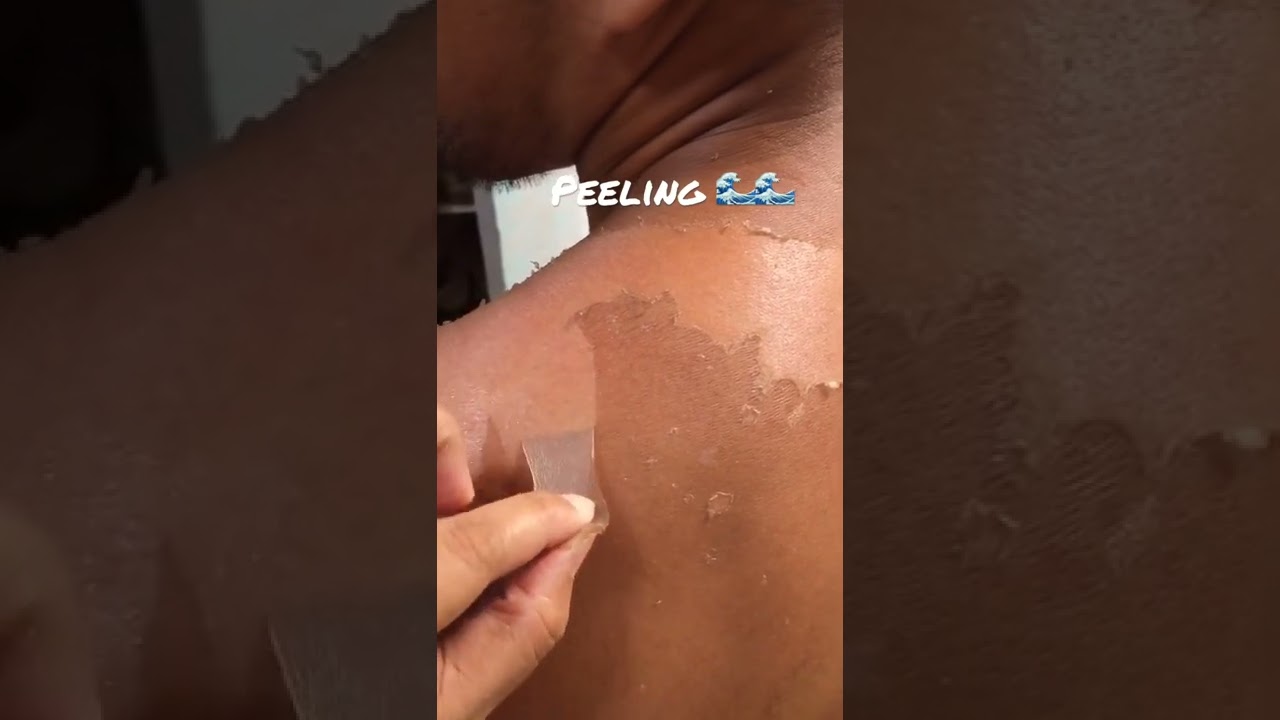 Skin peeling Satisfying 🌊☀️ #gavsventures #summervibes #summer2025 #2025 #summer