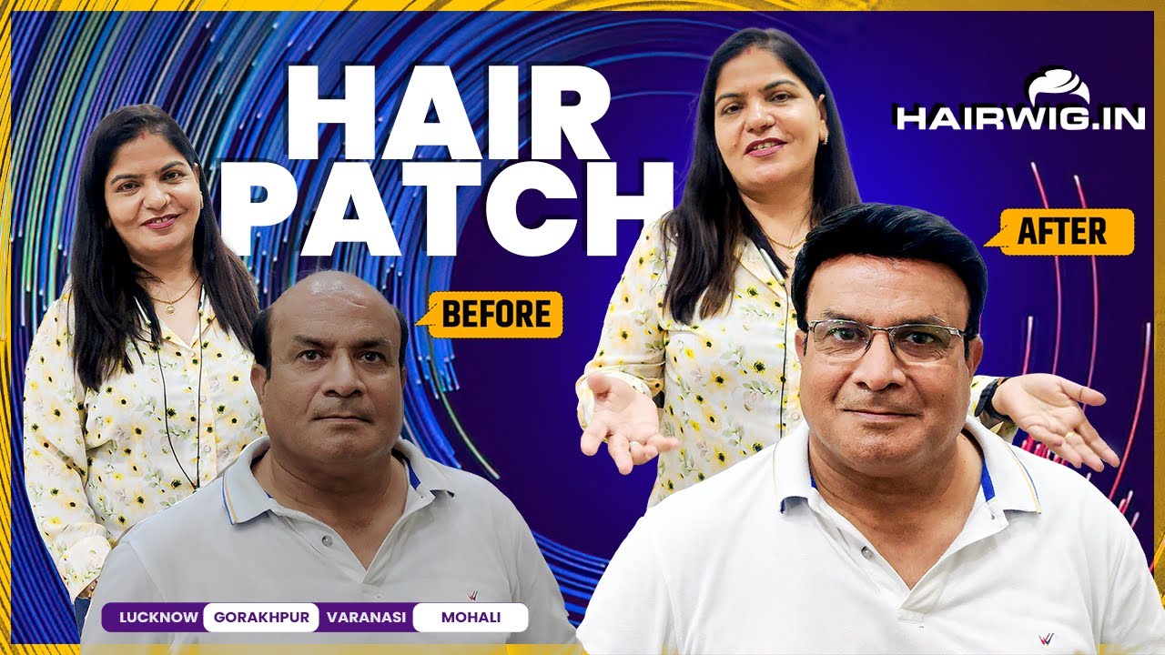 Men Hair Patch | #style #transformation #PinkiSingh #lucknow #trending #viral #hairwig #hair #hair