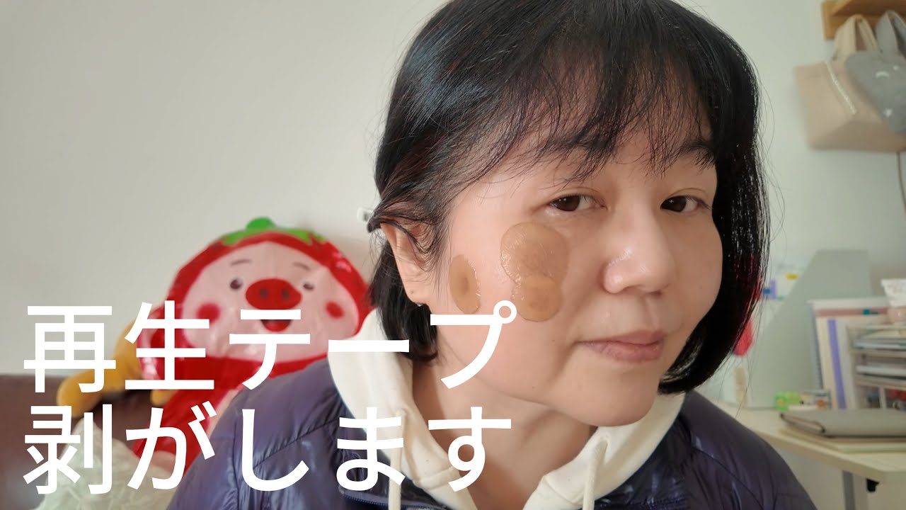 【韓国リポットレーザー】やっと剥がす時がきた｜リアルレポ