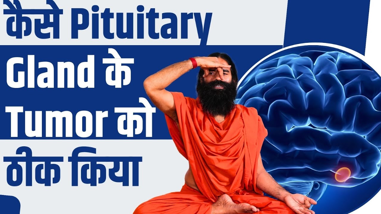कैसे Pituitary Gland के Tumor को ठीक किया || Swami Ramdev