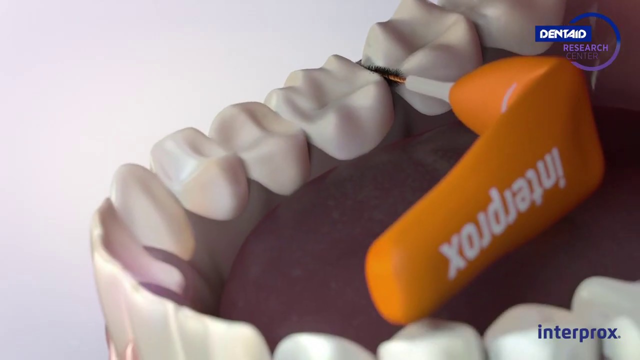 Die Revolution der Zahnzwischenraumpflege. Neue Interprox&reg;