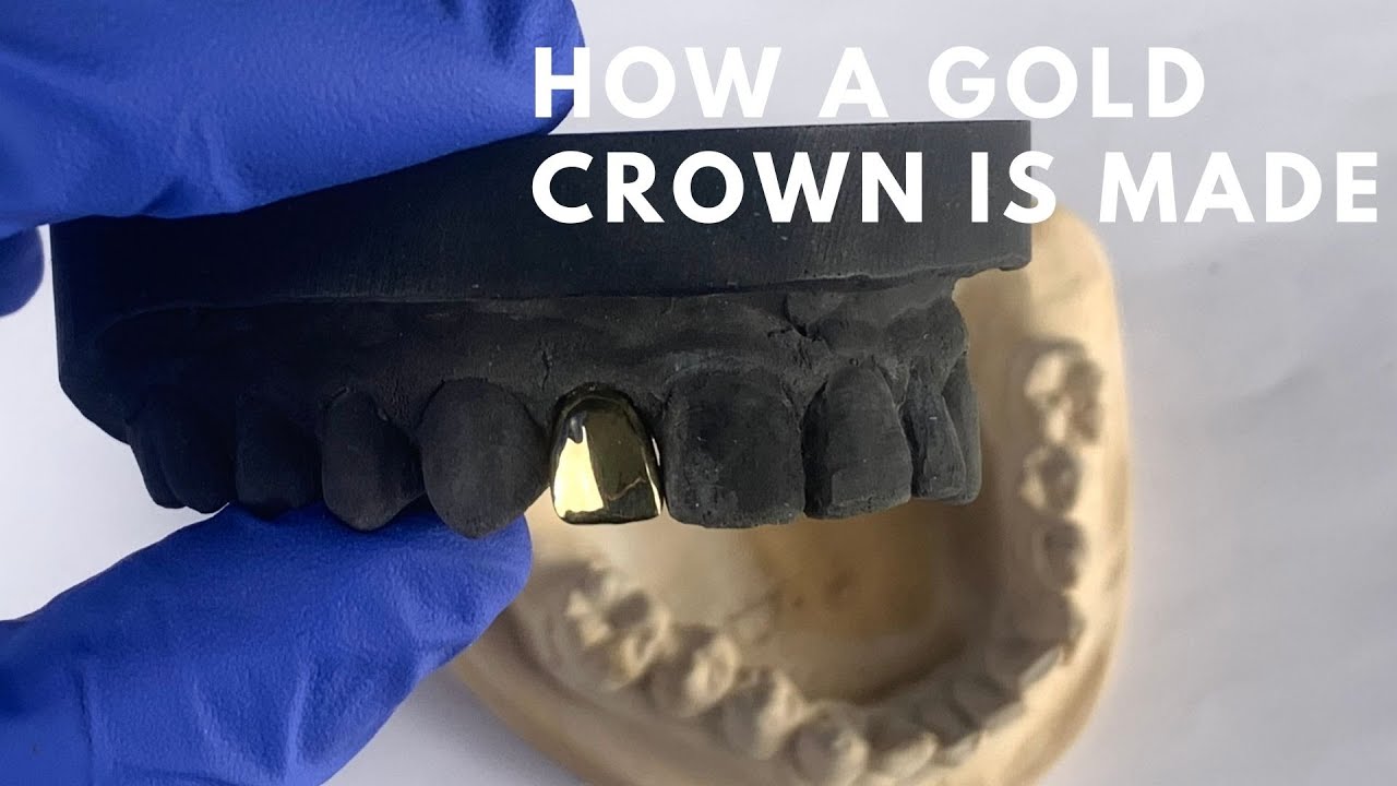 How A Gold Crown Is Made