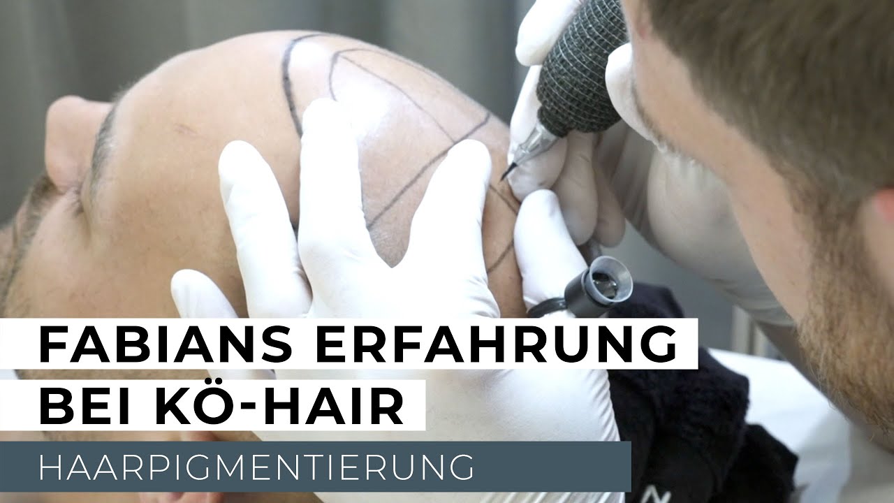 Fabian Nickel Erfahrungsbericht Haarpigmentierung - KÖ-HAIR