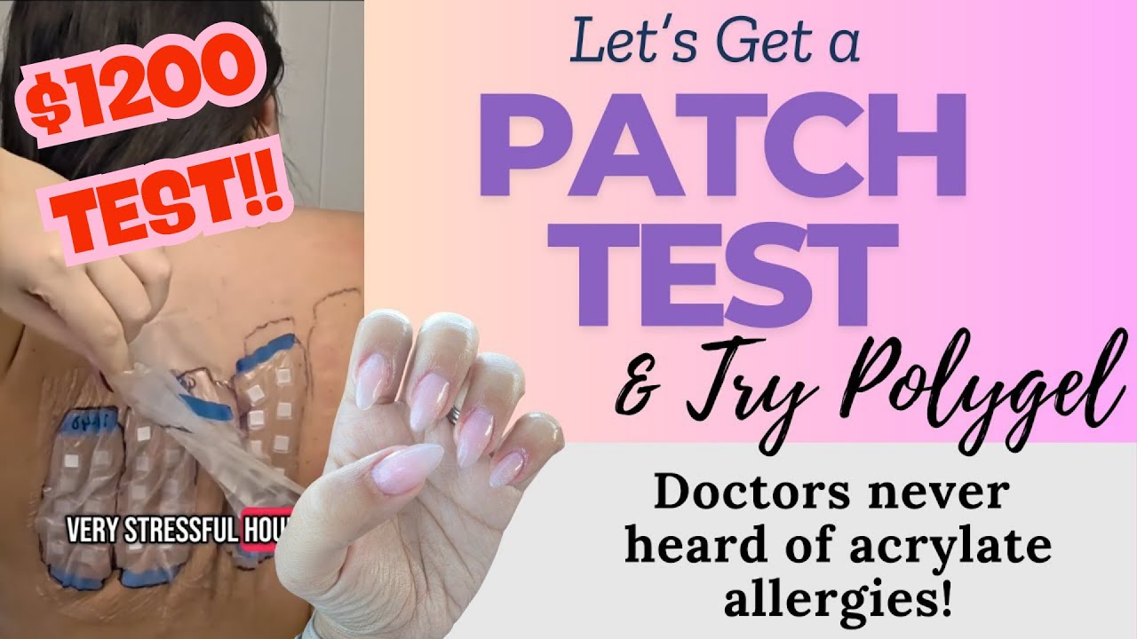 I Got a $1200 Allergy Test... and Learned Nothing | Can I Still Use Polygel?