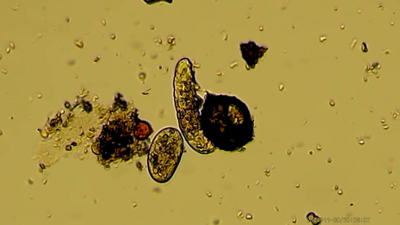 Niesporczaki (Tardigrada) i różne pierwotniaki pod mikroskopem