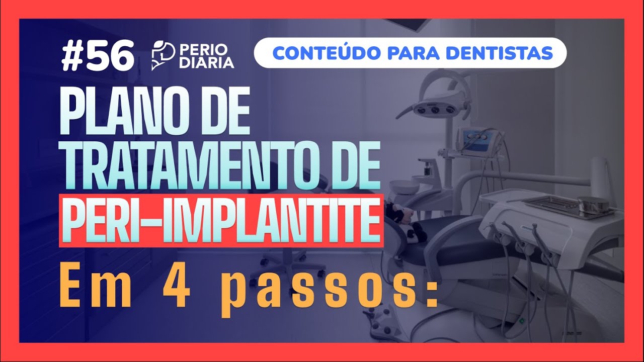 #56 - Plano de tratamento de PERI-IMPLANTITE em 4 passos
