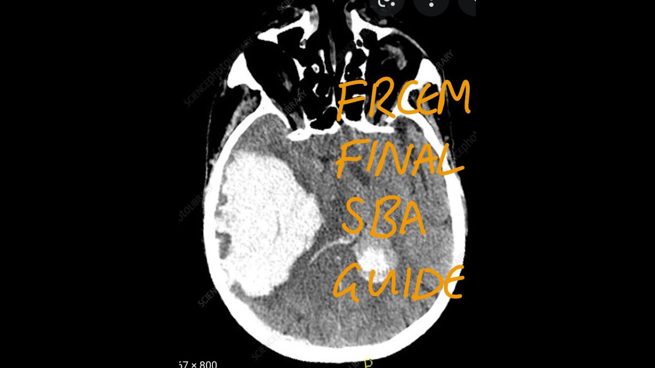 FRCEM Final SBA Guide