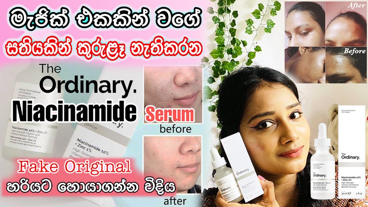 The Ordinary Niacinamide 10% + Zinc 1% | My Honest Review in Sinhala | සතියකින් කුරුළෑ නැතිකරන
