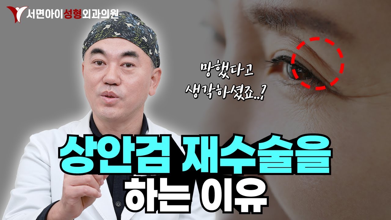 상안검 재수술을 하는 이유 💥! 눈 수술 망했다고 생각하시면 일단 들어와보세요..!!!