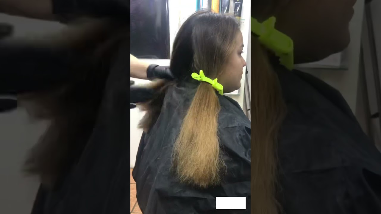 Repigmentación