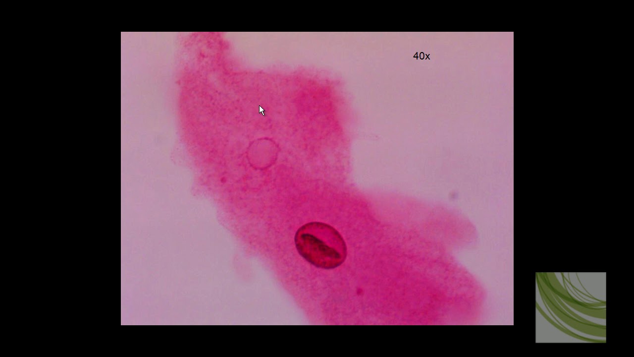 ORGANISM SLIDE: Amoeba proteus slides