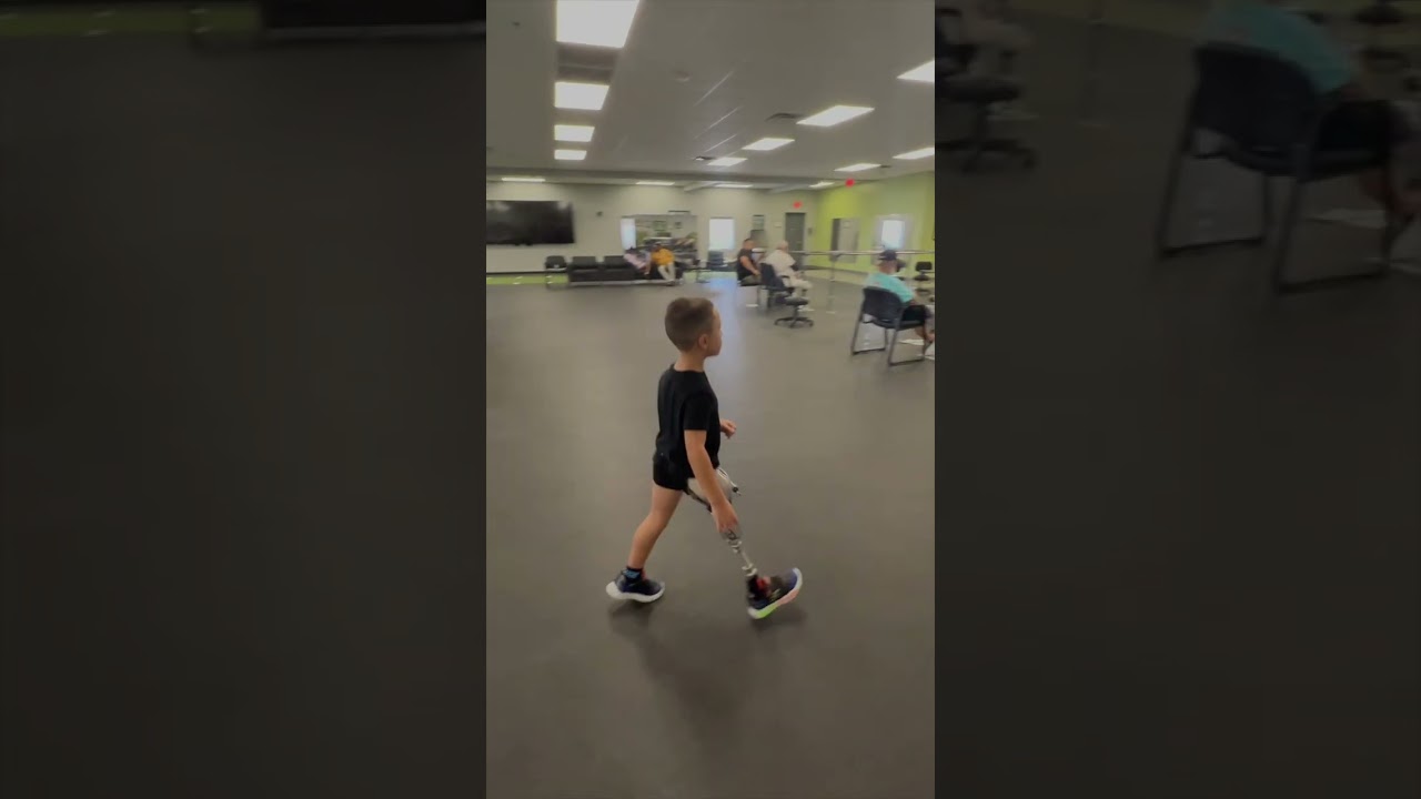 Jayden's New AK Prosthetic Leg with Hydraulic Knee!
