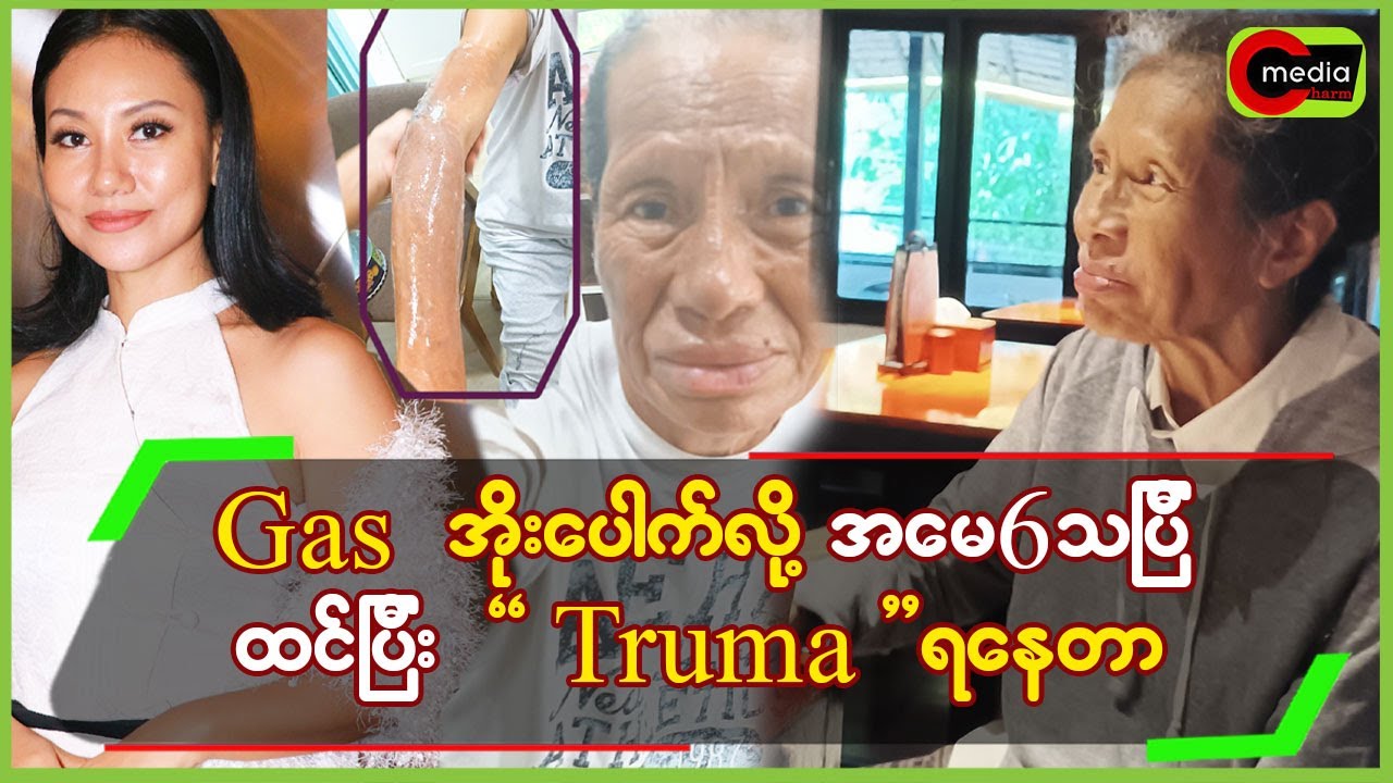 Gasအိုးပေါက်လို့ အမေ6သပြီထင်ပြီး “Truma”ရနေတာ