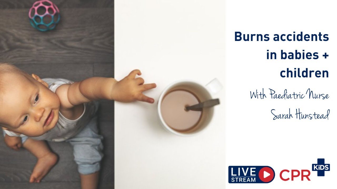 Burns accidents in babies + children
