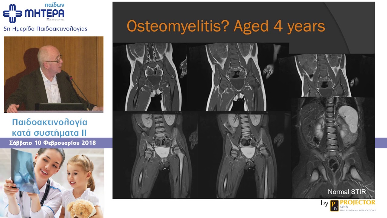 MRI of the bone marrow in children - K. McHugh