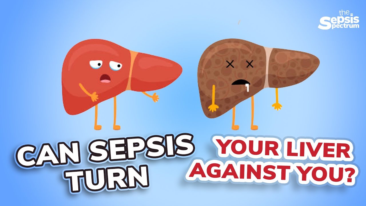Может ли сепсис настроить печень против вас? | The Sepsis Spectrum