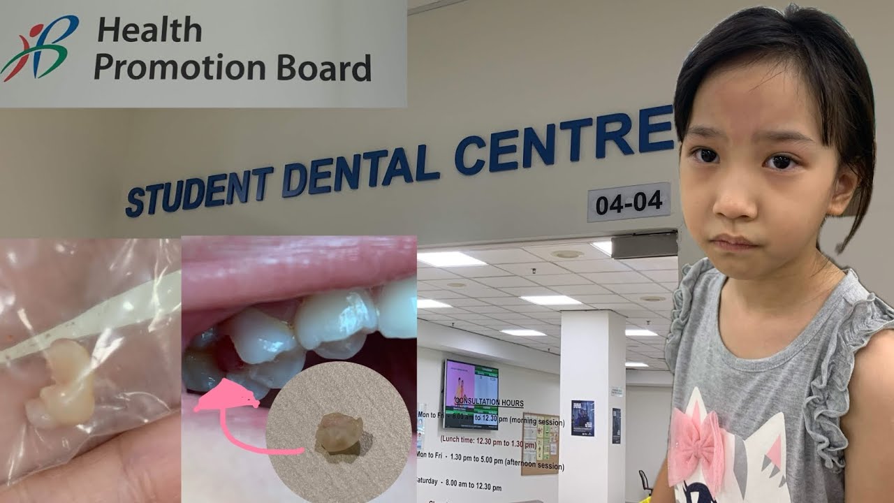 Ep360 Dental Journey (ep1) เด็กสิงคโปร์หาหมอฟันฟรีที่ HPB ถอนฟันที่หักครึ่ง