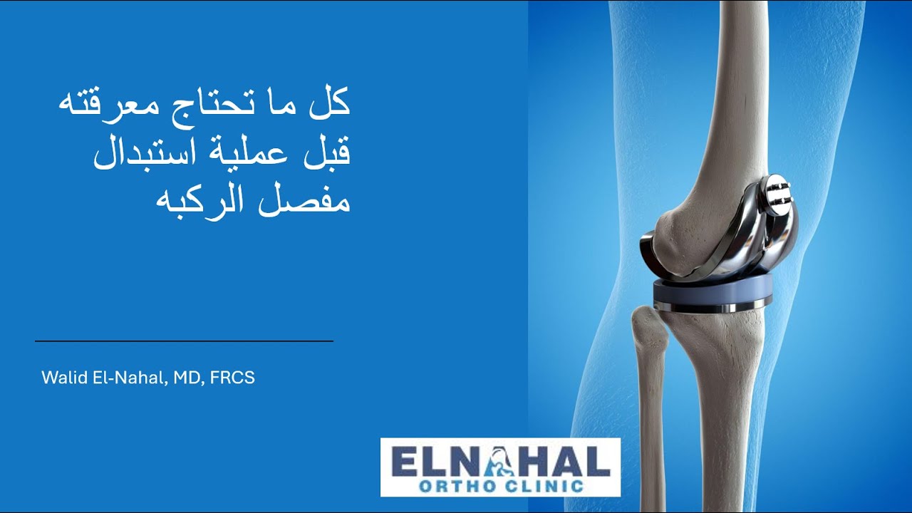 كل ما تحتاج ان تعرفه قبل عمليه تغيير (استبدال) مفصل الركبة - دكتور وليد النحال