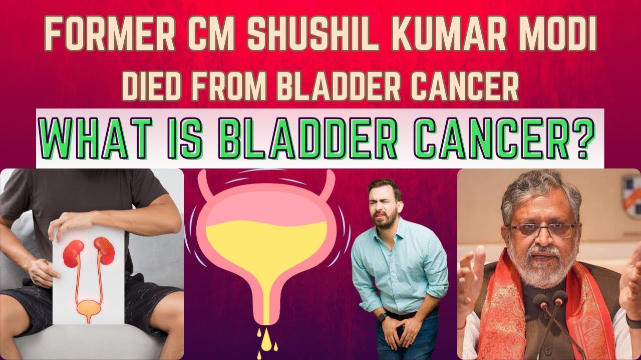 Sushil Kumar Modi Died Due to Urinary Bladder Cancer | Definition, Causes & Symptoms #cancer