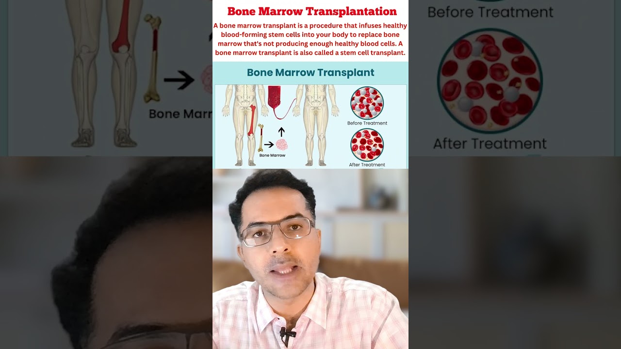 Treatment Options for Chronic Myelogenous Leukemia(CML) India, 