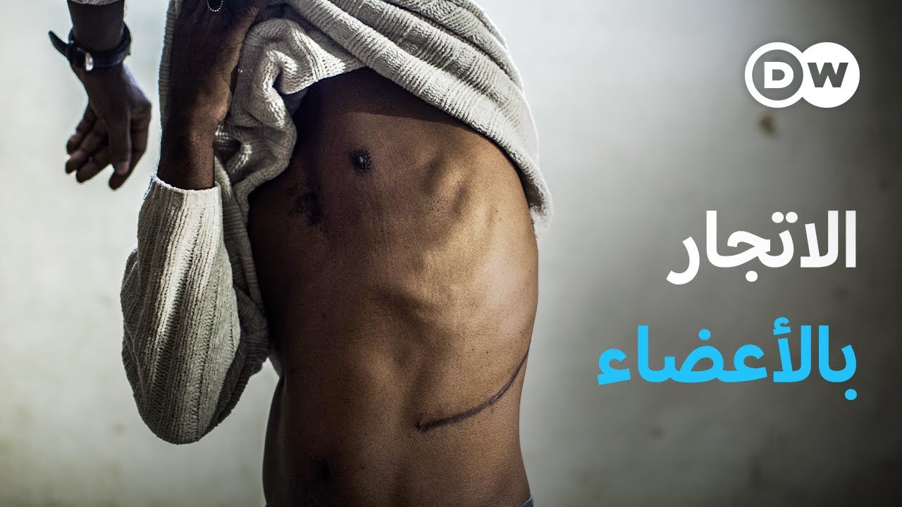 ريبورتاج | الشبكة العالمية للاتجار بالأعضاء | وثائقية دي دبليو