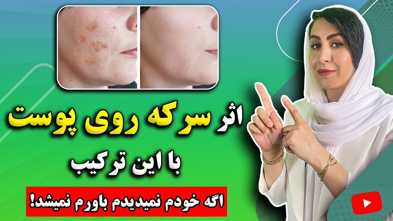 سرکه برای چی خوبه؟ : 5 نوشیدنی درمانی شگفت انگیز با سرکه برای زیبایی پوست، رفع چروک، لکه ها و...
