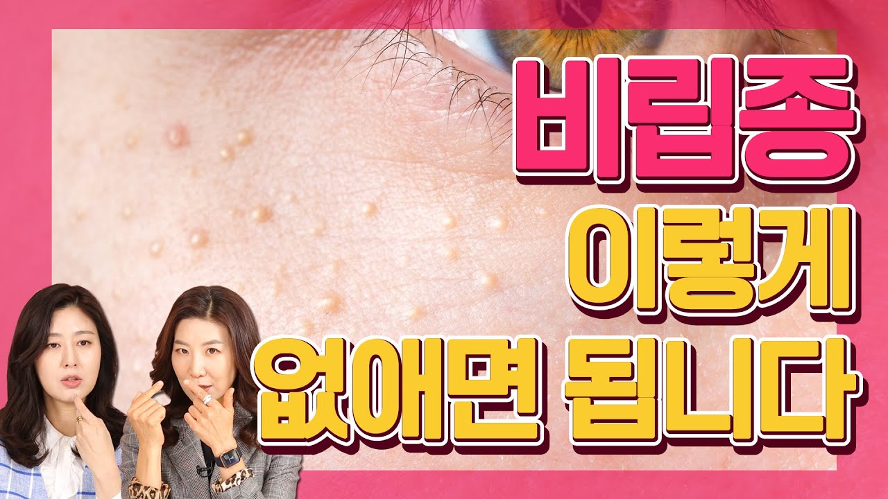 비립종이 잘 생기는 이유는 따로 있다? - 예뻐지는 굿라이프 #40 비립종제거
