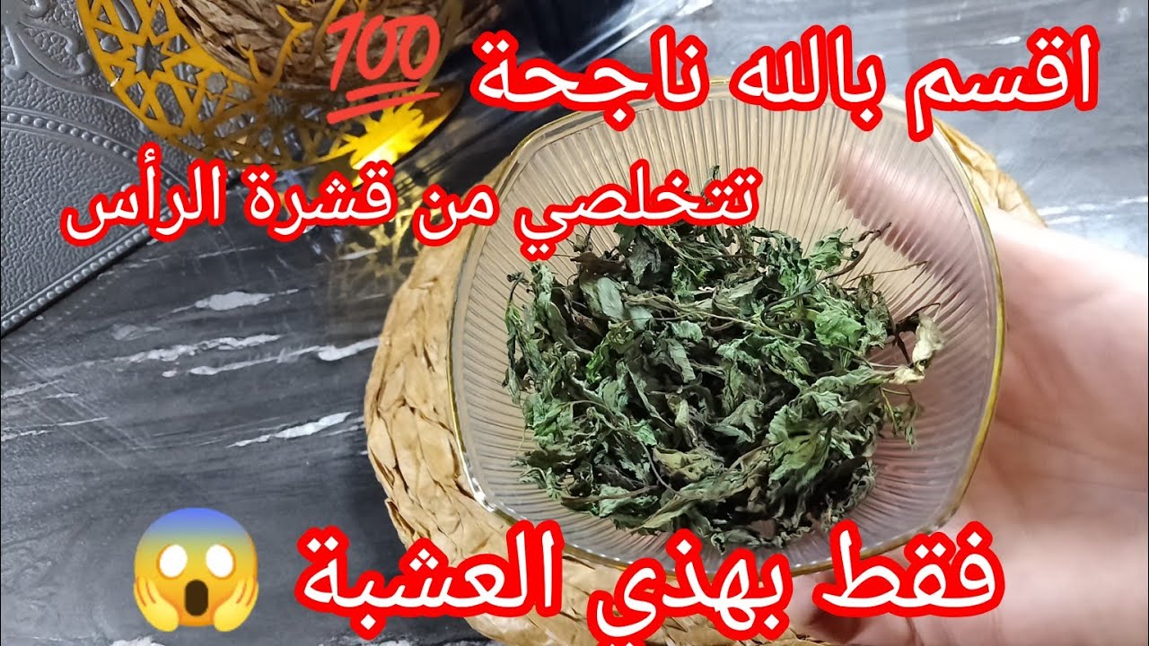 علاج قشرة الرأس فقط بمكون واحد 💪 تتخلصي منها من أول تجربة وصفة مجربة منذ سنين 💯