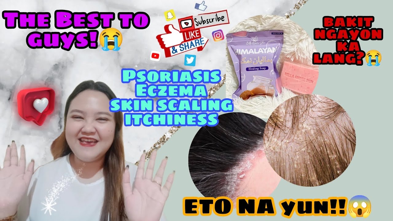 HIMALAYAN SOAP HONEST REVIEW | Finally I found the one🤩