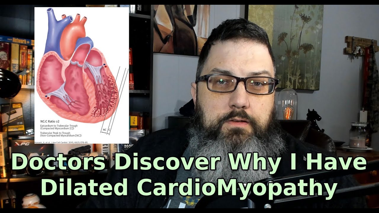 Doctors Discover Why I Have Dilated Cardiomyopathy