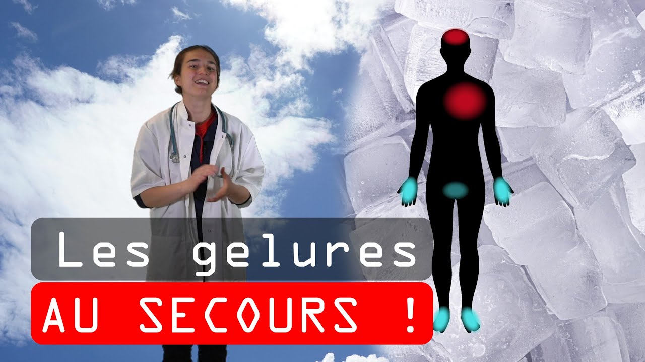 Au secours : Les gelures