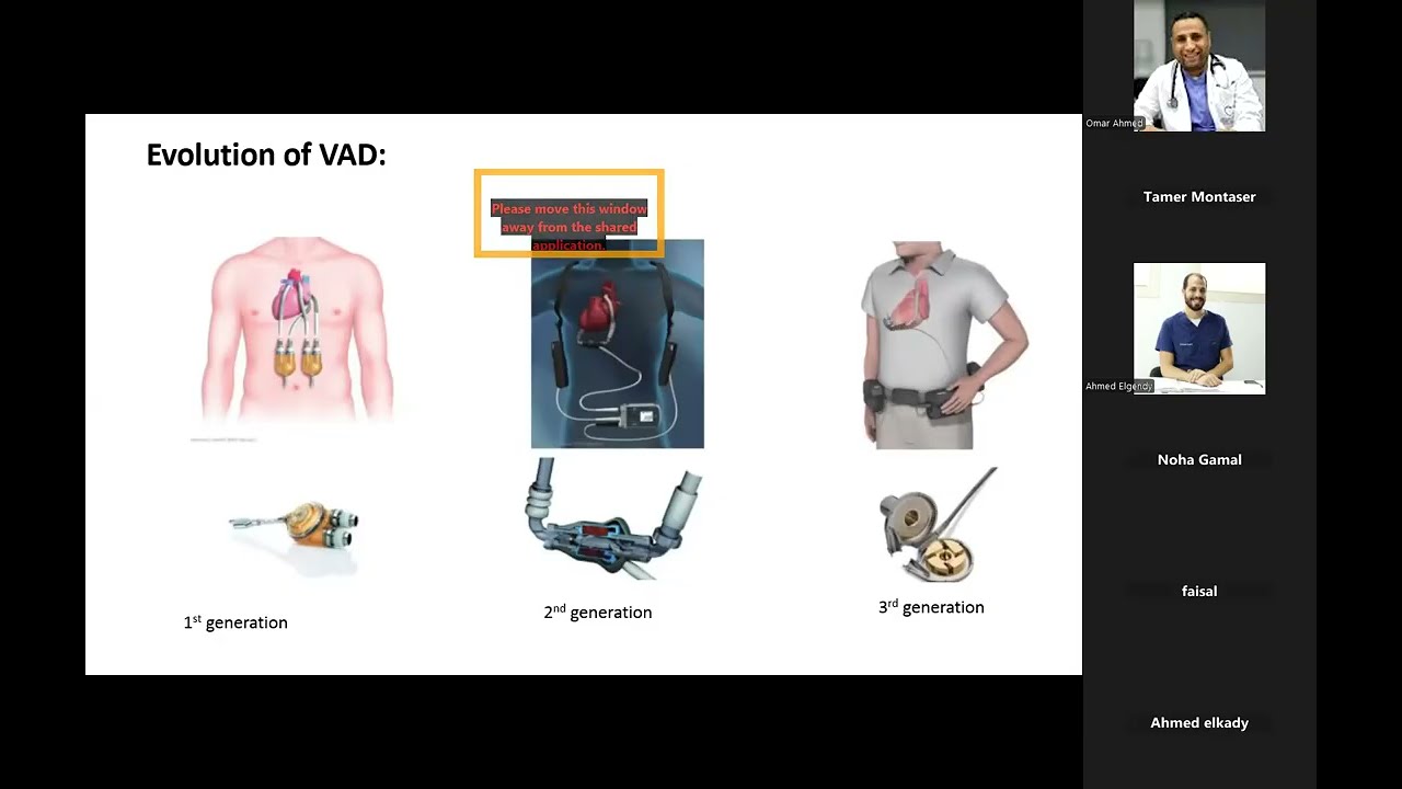 3  Anasthesia Consideration in LVAD insertion
