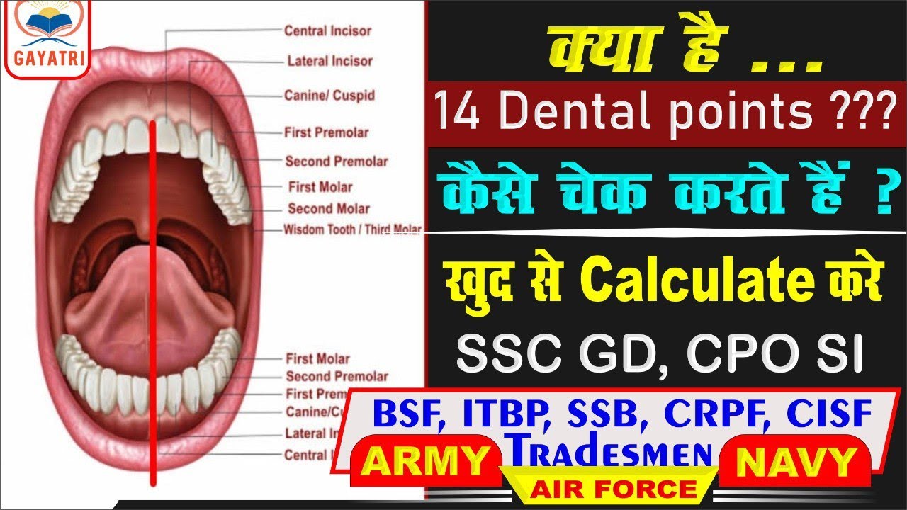 क्या है? || 14 Dental Points??? || कैसे चेक करते हैं || ख़ुद से Calculate करें || SSC GD, CPO SI,