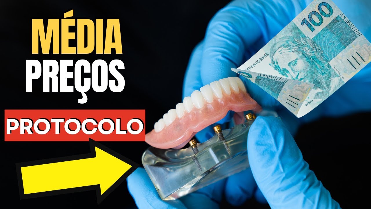 PREÇO DENTADURA FIXA  no brasil - Prótese Protocolo