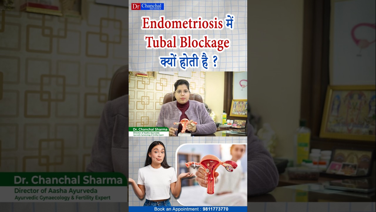 What is Endometriosis and How does it cause Tubal Blockage?  - Dr Chanchal Sharma