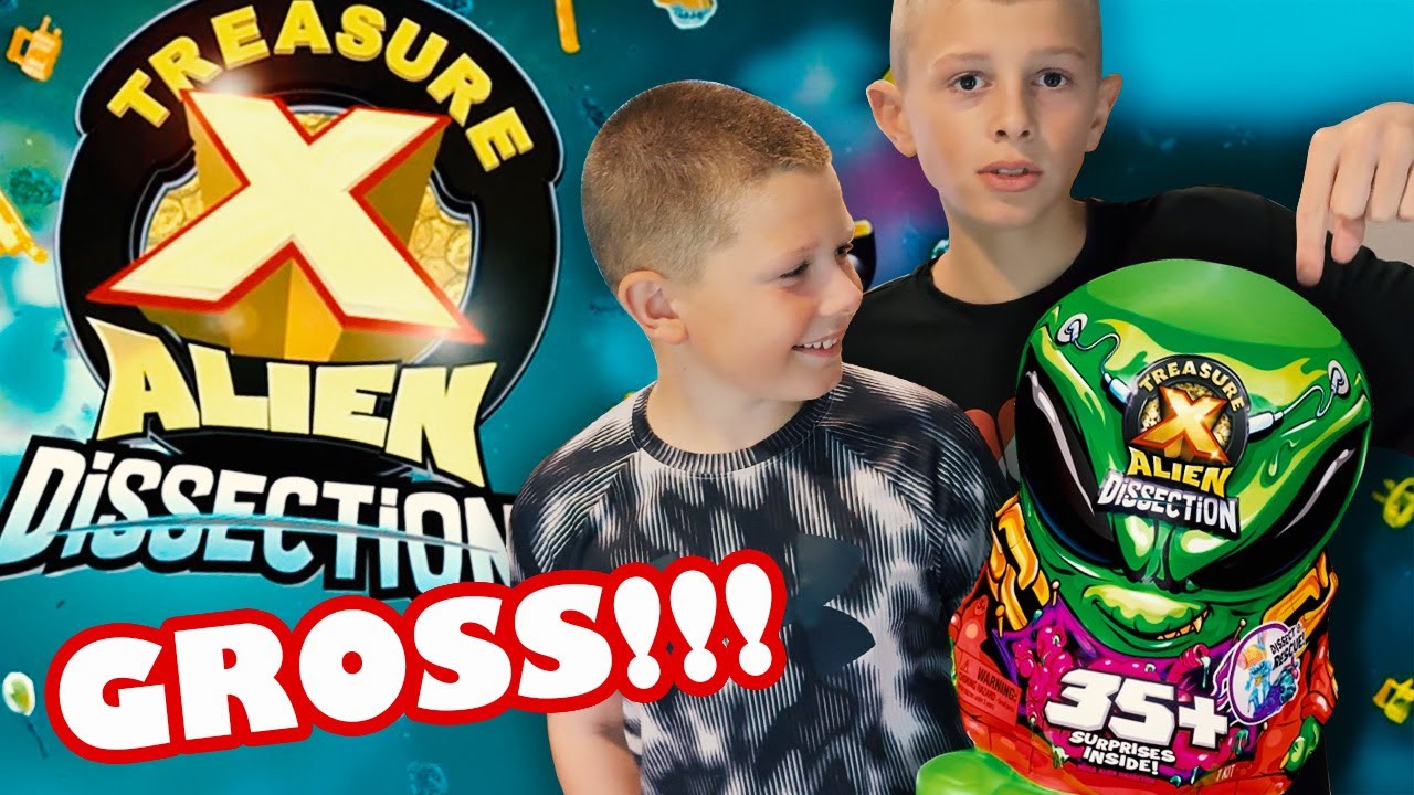 Treasure X Alien Dissection Kit FINALLY opened!