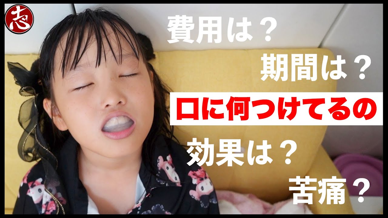 【子供の矯正】長女ちゃん寝る前なにしてんの？ キレイラインキッズを1年２ヶ月続けてみた結果・・・！