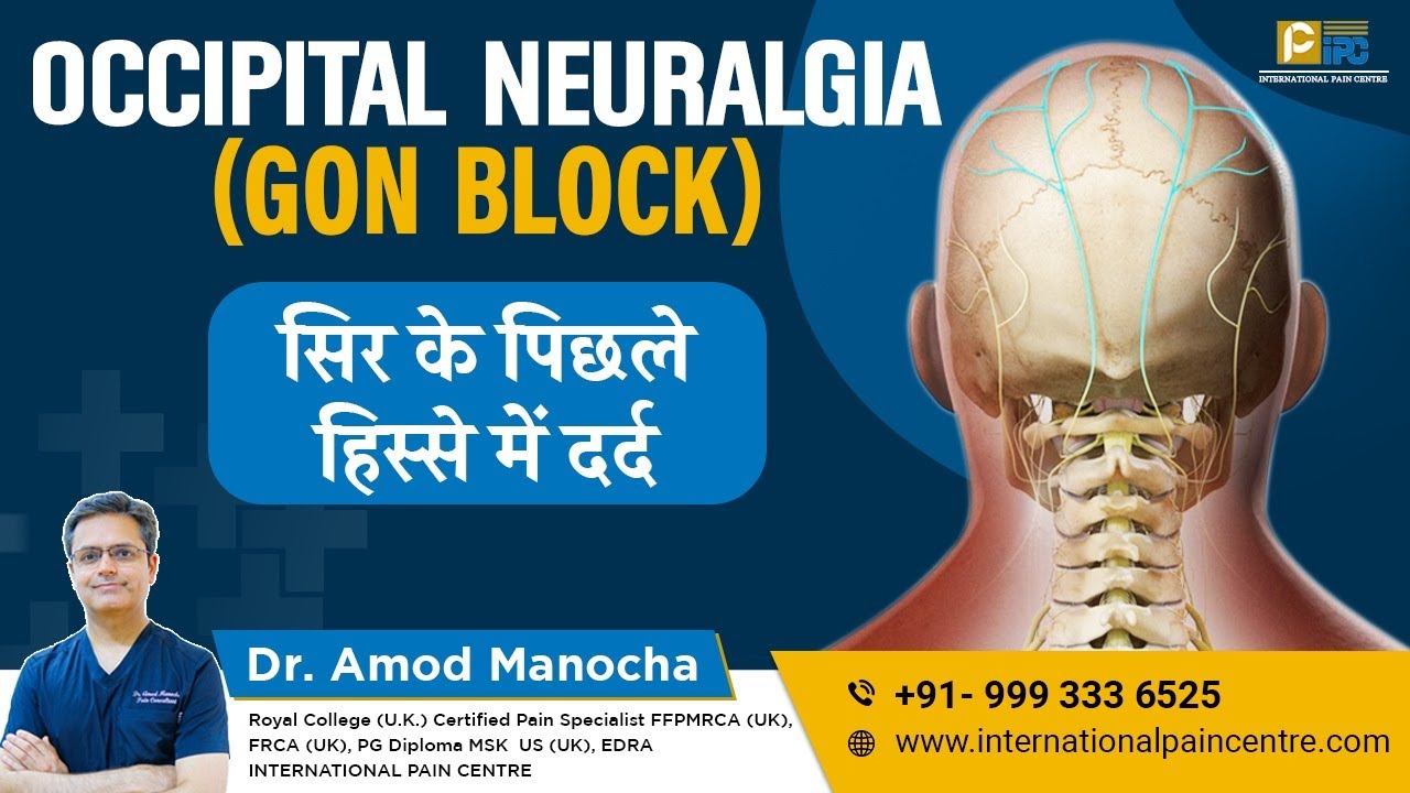 Occipital Neuralgia & GON Block / सर के पीछे का दर्द by Dr. Amod Manocha, International Pain Centre