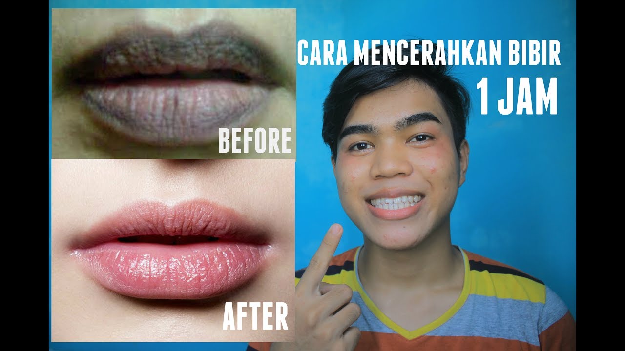 TIPS MENCERAHKAN BIBIR YANG GELAP DENGAN CEPAT || DALAM 1 MALAM || RAHUL EFENDY