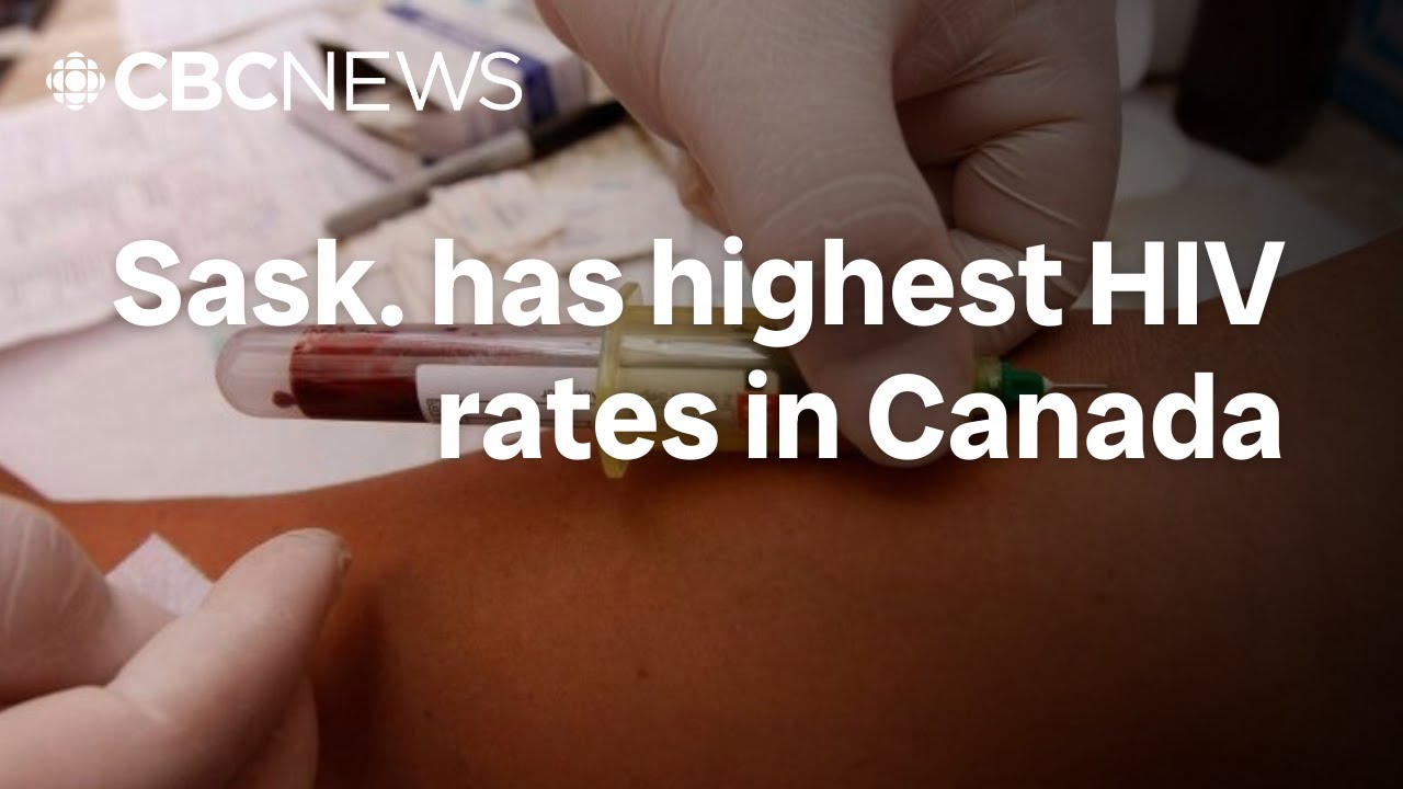HIV rates in the province are the highest in Canada | This is Saskatchewan