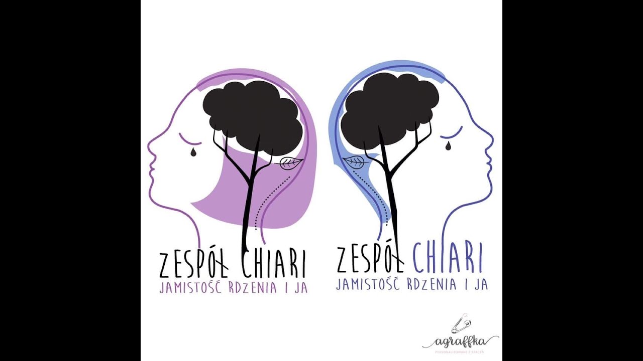 Zesp&oacute;ł Chiari, jamistość i ja