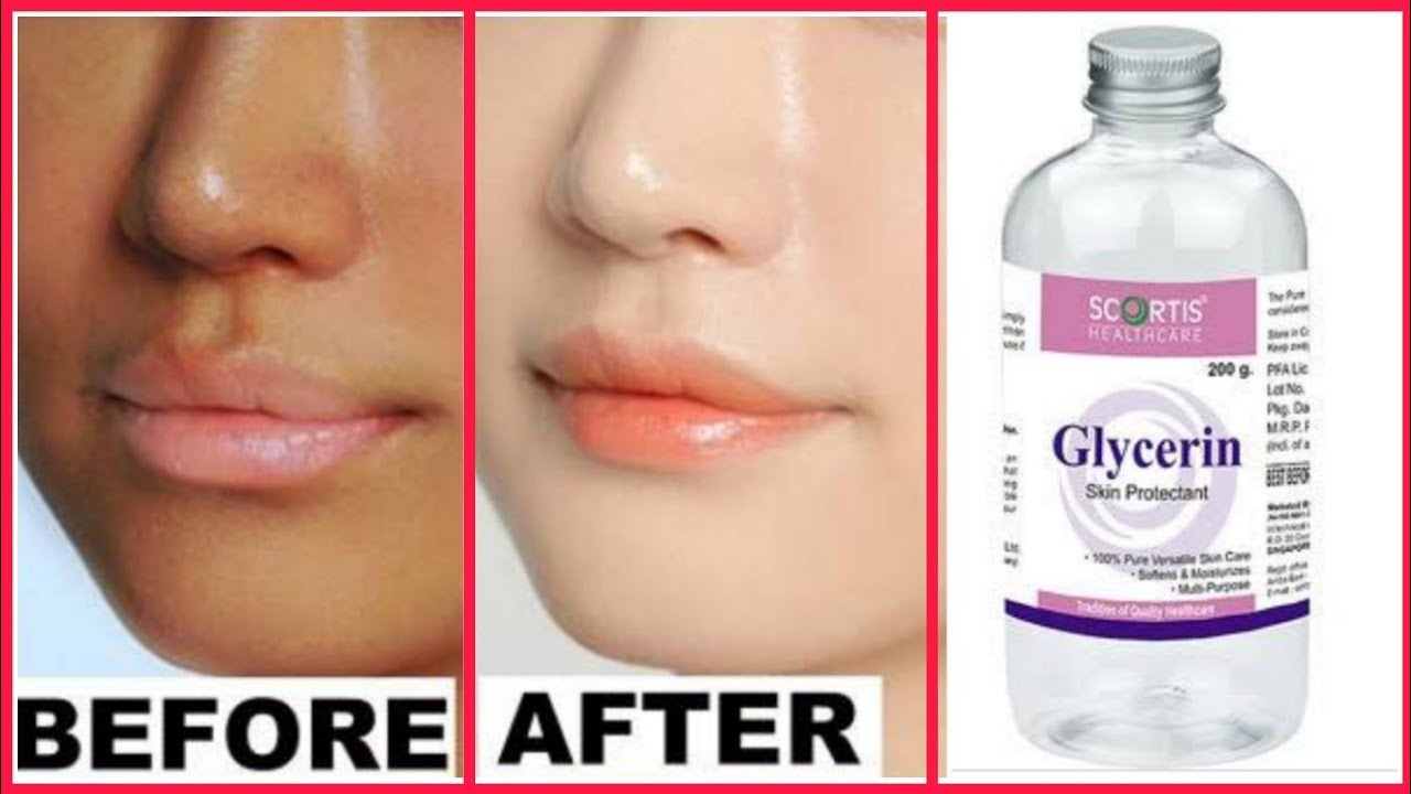 Use Glycerin This Way Your Skin Will Become So Young, Tight n Glowing | Glycerin for Face | 💁