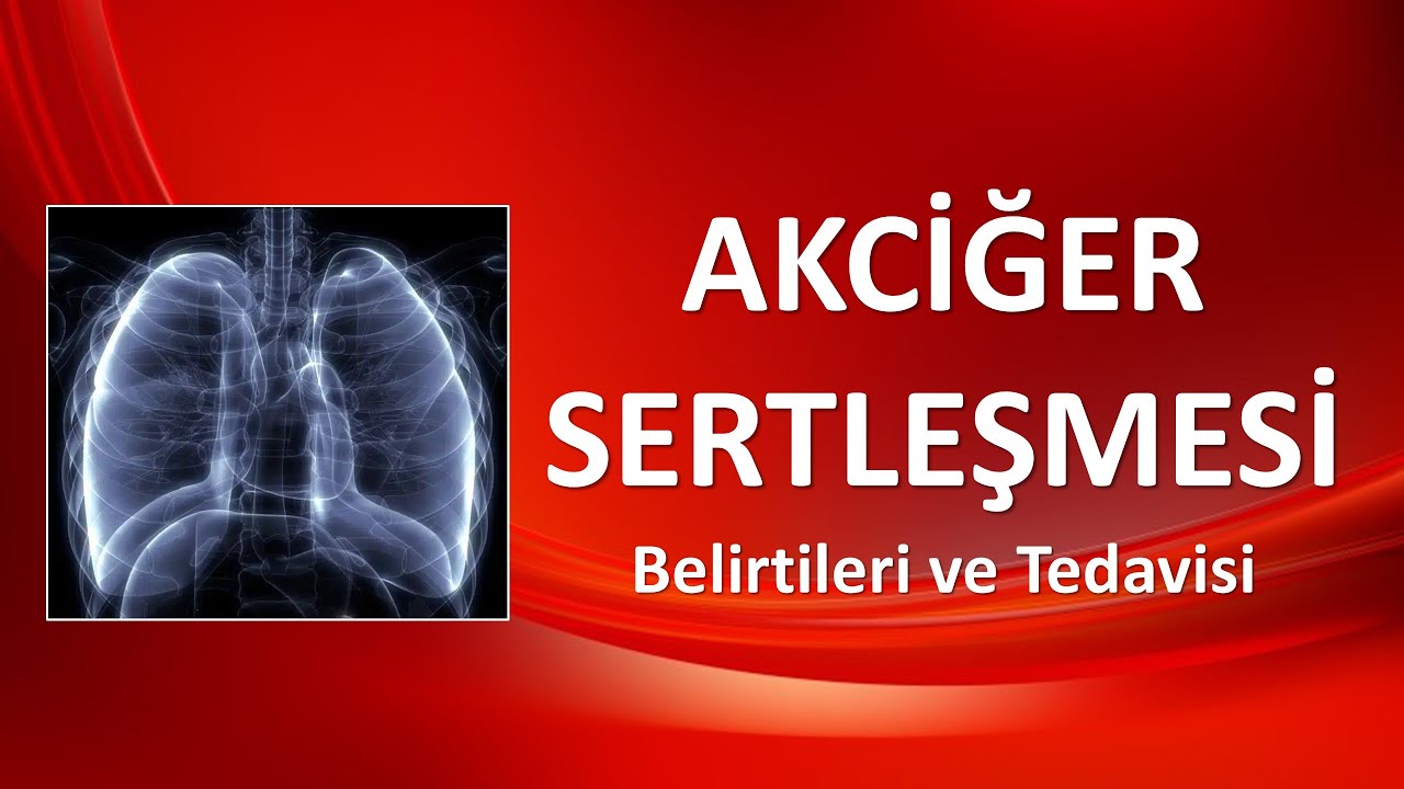AKCİĞER SERTLEŞMESİ Belirtileri ve Tedavisi