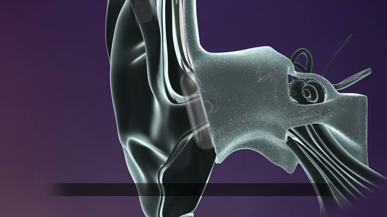 How The Osia® System Works