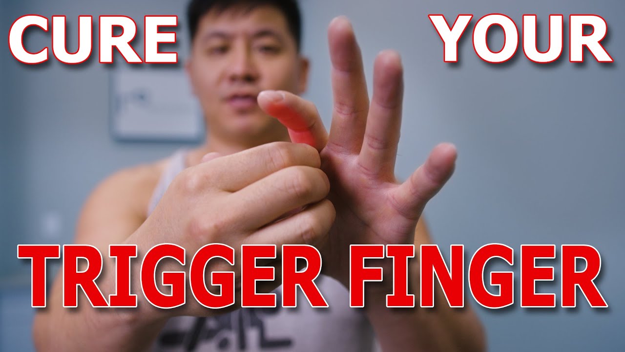 Unlocking the Solution to Trigger Finger and Trigger Thumb