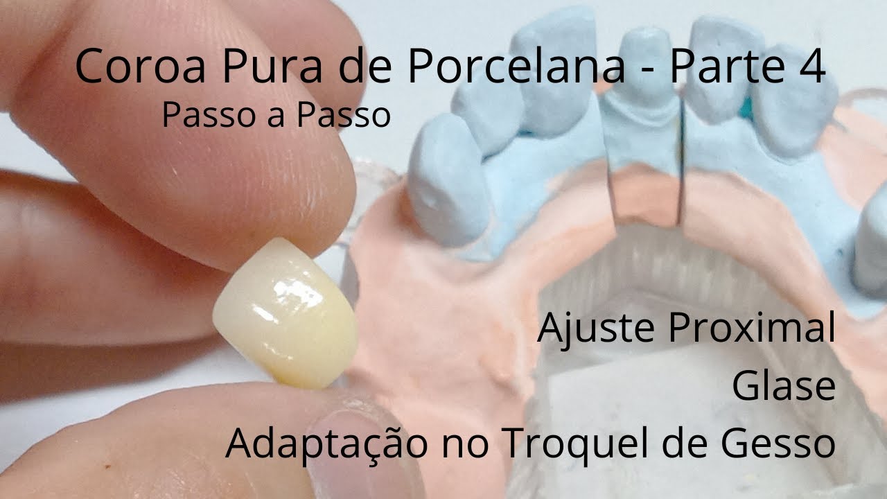 Porcelana Pura Passo a Passo Parte 4 - Ajuste Proximal, Glase e Adaptação no Troquel de Gesso.