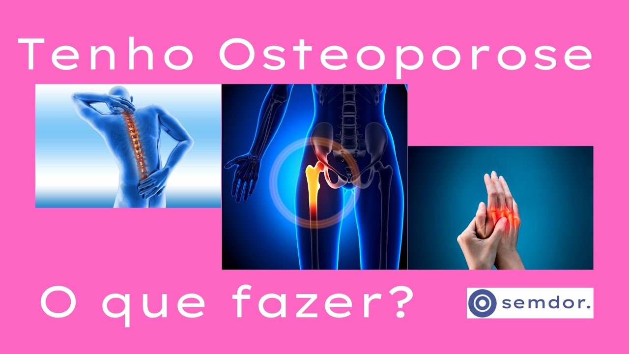 Tenho osteoporose. O que fazer?