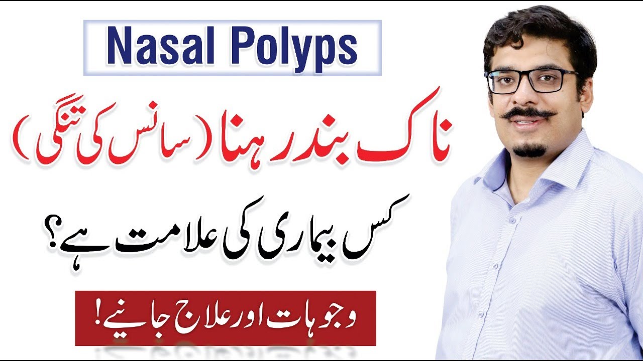 Nasal Polyps - Causes, Symptoms & Treatment | Naak ki haddi | By Dr. M Ali Raza